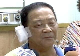 �����M�h���h�T�Rͬ�f�҂��Ğ����ҕ�؈D